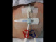 Velcro binder set big / Fixation for drivelines, ECMO, thoracic drains and urinary catheter