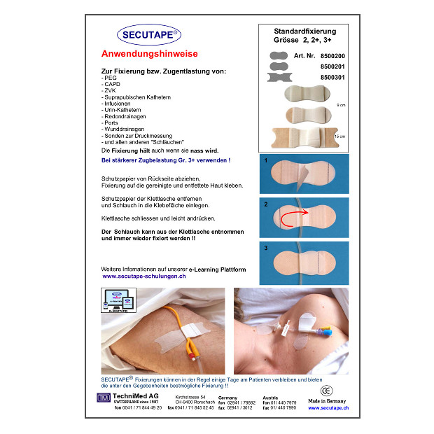 ANWENDUNGSHINWEISE-STANDARDFIXIERUNG-GROESSE-2